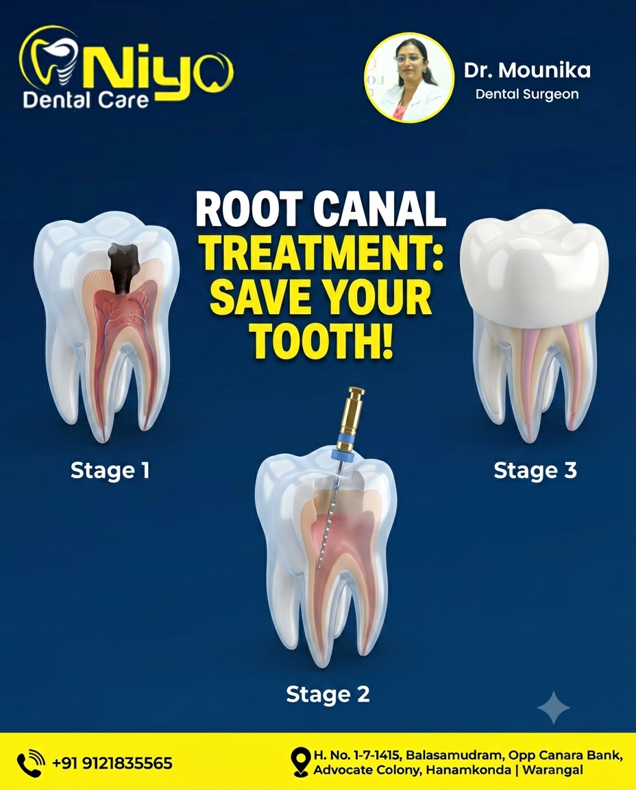 Say Goodbye to Tooth Pain: Painless Root Canal Treatment (RCT) at Niyo Dental Care!
